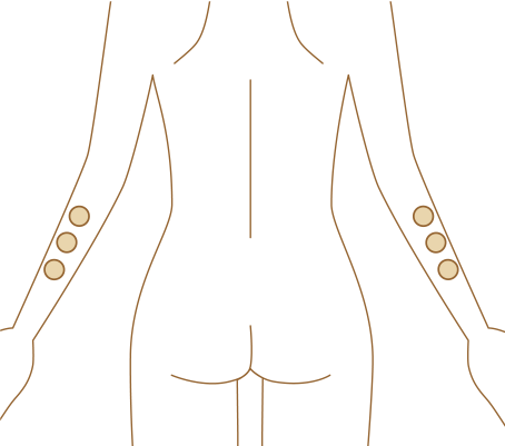 “腕にコリを感じたら”この貼り方